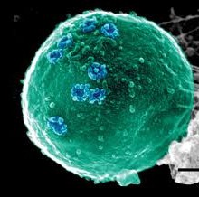Energy Healing, Stress and Natural Killer Cells